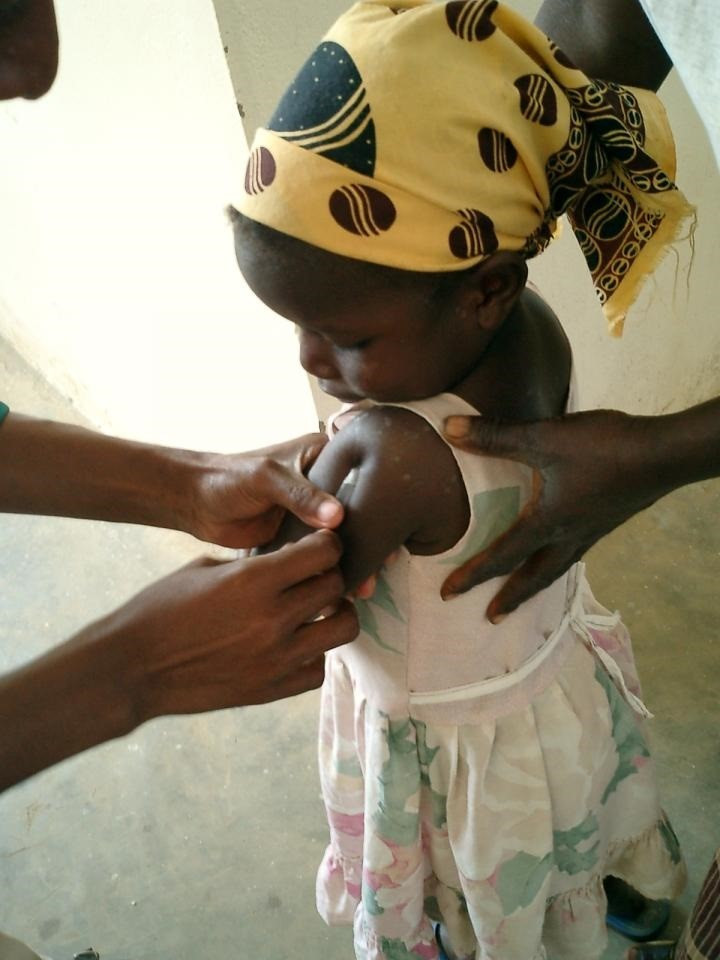 Archivo - Una niña en un centro de salud de Mozambique recibe una inyección de la vacuna contra la malaria