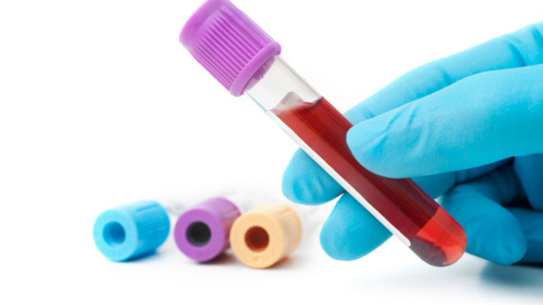 Analisis Sangre