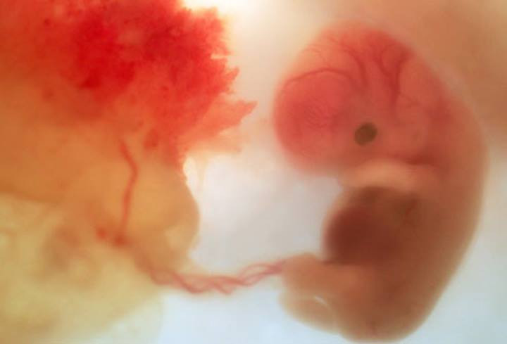 Un embriu00f3n humano de unas 8 semanas