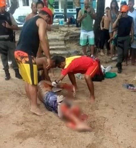 Turista pierde pierna en ataque de tiburu00f3n