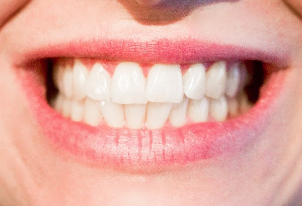 Sonrisa