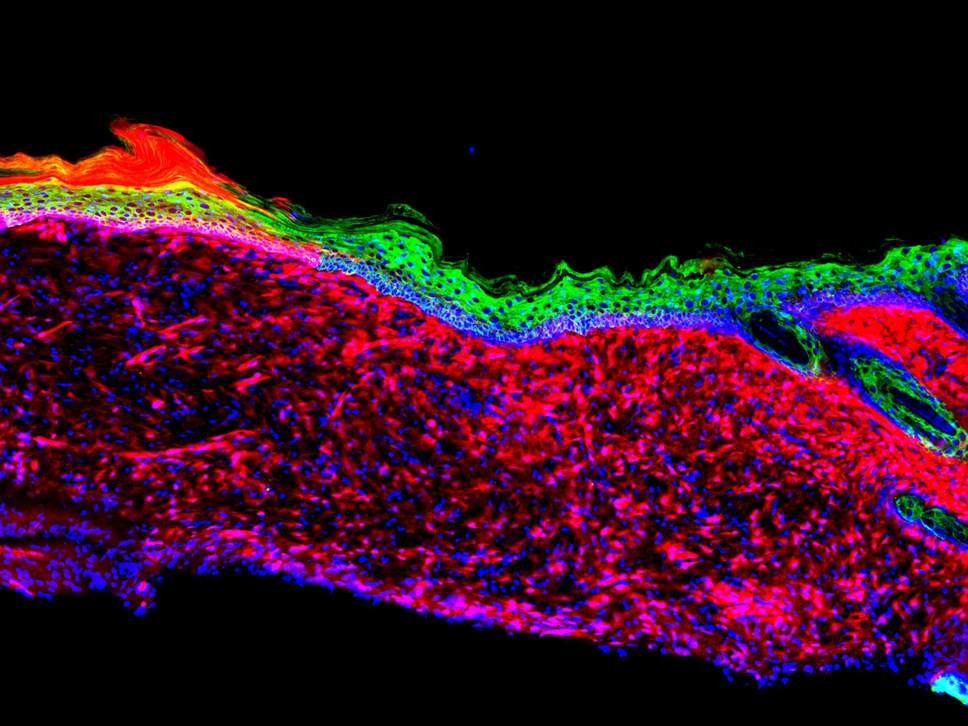 Los tejidos epiteliales se generaron mediante la conversiu00f3n de un tipo de cu00e9lula en otro dentro de una u00falcera grande en un modelo de ratu00f3n de laboratorio Salk Institute