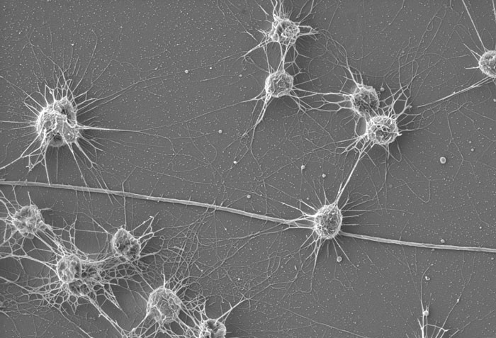 Estas archaea, Altiarchaeales, fueron encontradas originalmente viviendo en manantiales sulfu00eddicos en Alemania