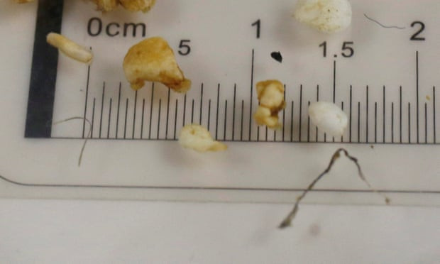 Microplu00e1sticos encontrados en el estu00f3mago de un mamu00edfero de las costas britu00e1nicas