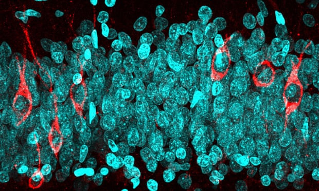 Imagen de neuronas nuevas en un hombre de 68 au00f1os