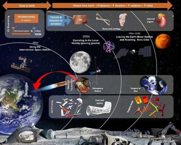 Infografu00eda de la Esa Sobre el proceso de bioimpresiu00f3n de piel y huesos