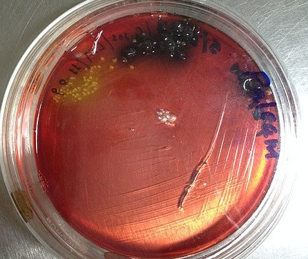 Listeria
