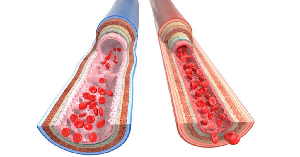 Comparaciu00f3n entre venas y arterias