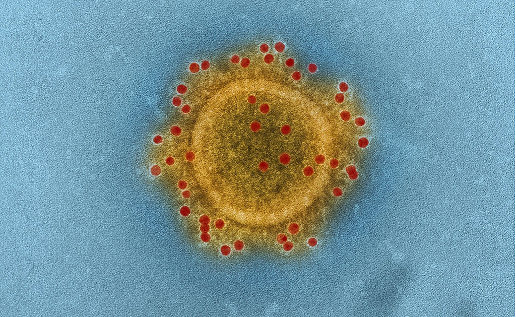 Partícula del coronavirus MERS