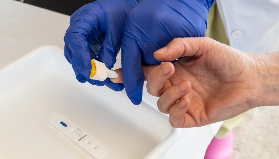 Test COVID-19 en Galicia.