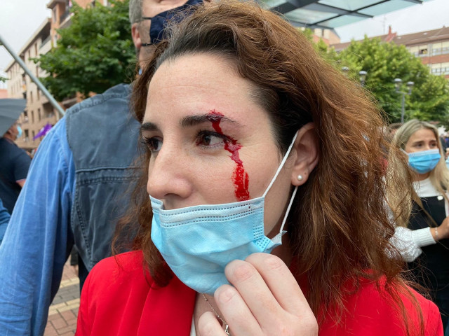 La diputada de Vox Rocío de Meer tras recibir una pedrada en Sestao