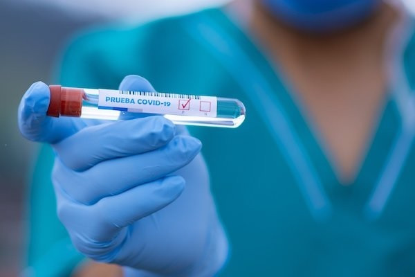 Test para detectar coronavirus