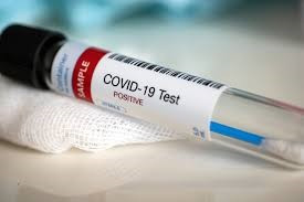 Prueba de COVID-19.