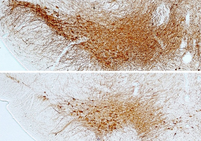 Imagen de las neuronas dopaminérgicas de la sustancia negra del cerebro.