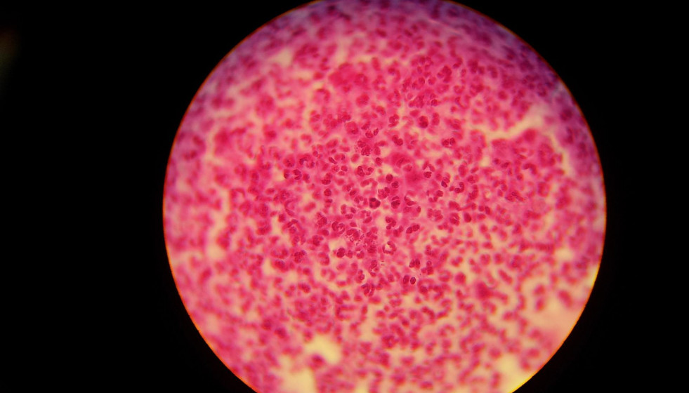 Gonorrea, Neisseria gonorrhoeae