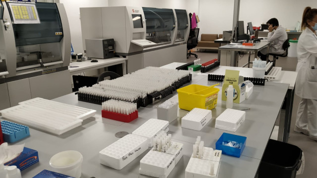 Muestras para la realización de pruebas PCR de COVID-19