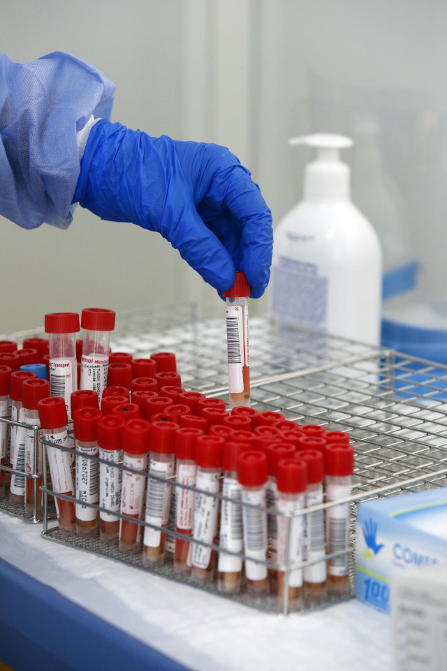 Tubos de pruebas PCR para la detección del COVID-19 en el 