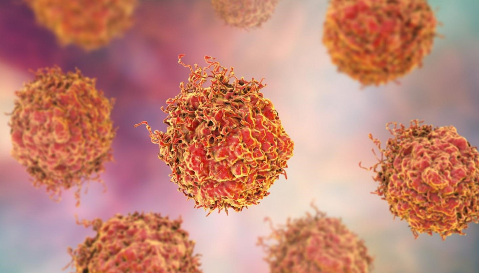 Células cancerosas de próstata.