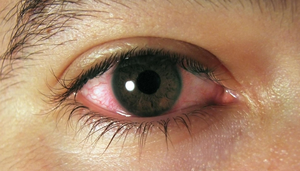 Archivo - Ojos