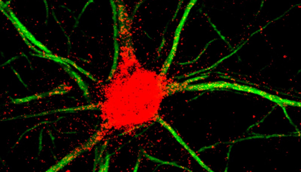 Tinción para eEF1A2 (rojo) en neuronas del hipocampo de ratones.