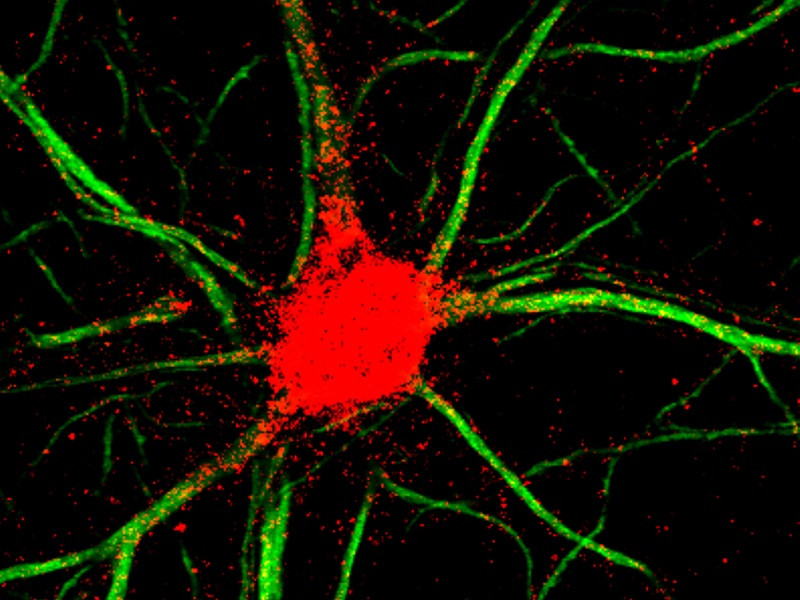 Tinción para eEF1A2 (rojo) en neuronas del hipocampo de ratones.