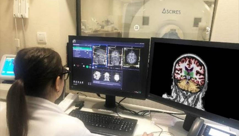 Archivo - La plataforma calcula volúmenes y realiza tractografías cerebrales, para diagnosticar enfermedades como el Alzheimer, la demencia, la epilepsia o la esclerosis múltiple.