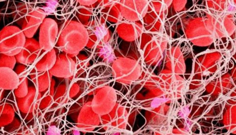 EuropaPress 1694212 investigadores csic desarrollan molecula inhibe heparina evitar reacciones