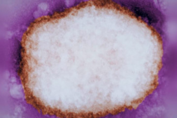 Partícula amplificada del virus de la viruela del mono.