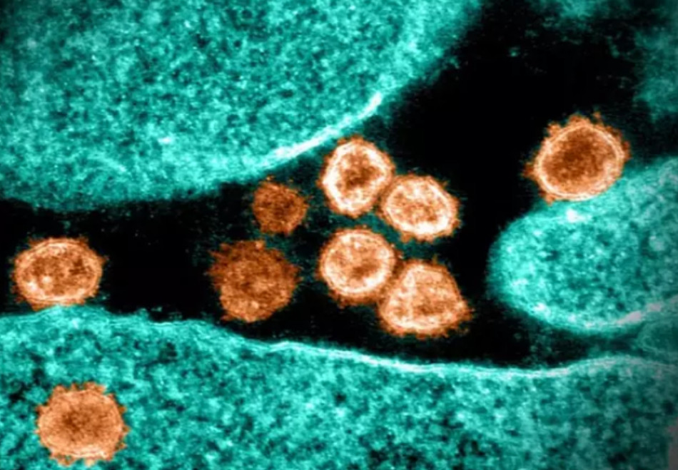 Pd antivirals