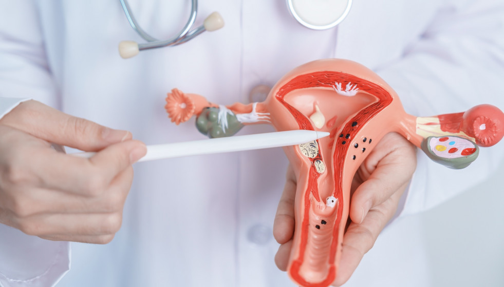 EuropaPress 5848428 cancer cuello uterino