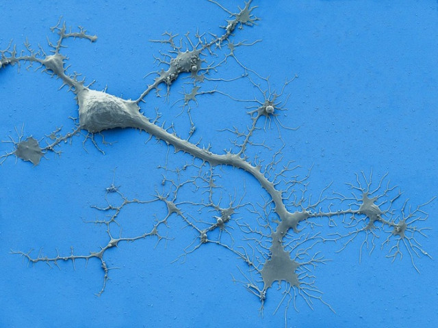 Archivo - Esta micrografía electrónica de barrido coloreada muestra una neurona humana cultivada con dendritas y axones.