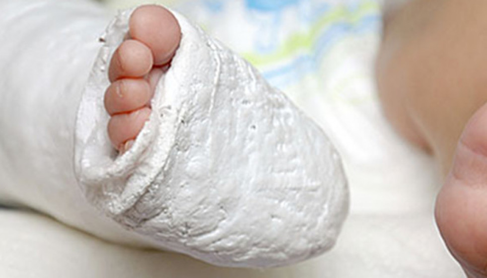 Osteoporosisinfantil