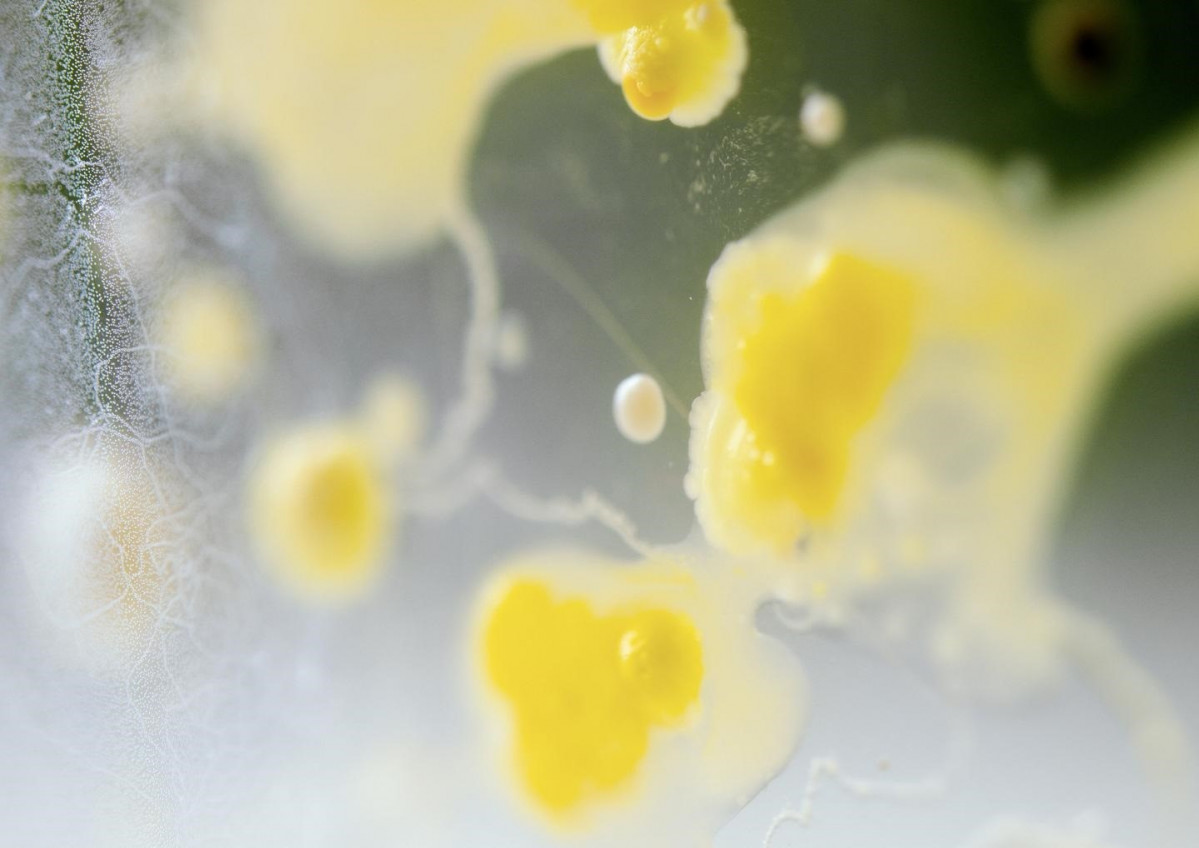 Cultivo bacteriano tomado de una muestra fecal.
